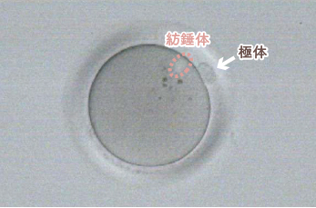 受精/培養:顕微授精法（ICSI）